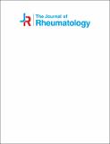 Rheumatoid Arthritis Initiating as Palindromic Rheumatism A Distinct Clinical Phenotype POSTPRINT-1.pdf.jpg