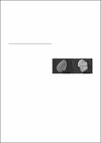 2013_Morato et al_Pinna-foraminifera_CIESM.pdf.jpg