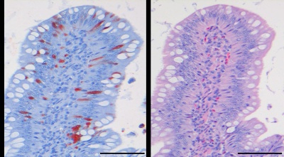 Immunohistochemistry showing multiple enterocytes positive for avian influenza virus and histology showing complete absence of lesions