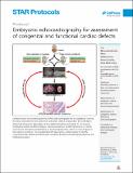 Embryonic_echocardiography_Menéndez_PV_Art2021.pdf.jpg